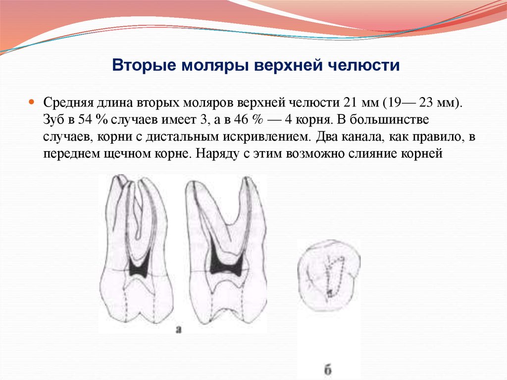 Коренные зубы вторым. Топография полости вторых моляров челюсти. Топография полости зуба 2 моляра верхней челюсти. Второй моляр верхней челюсти анатомия каналов. Второй моляр верхней челюсти топография полости.