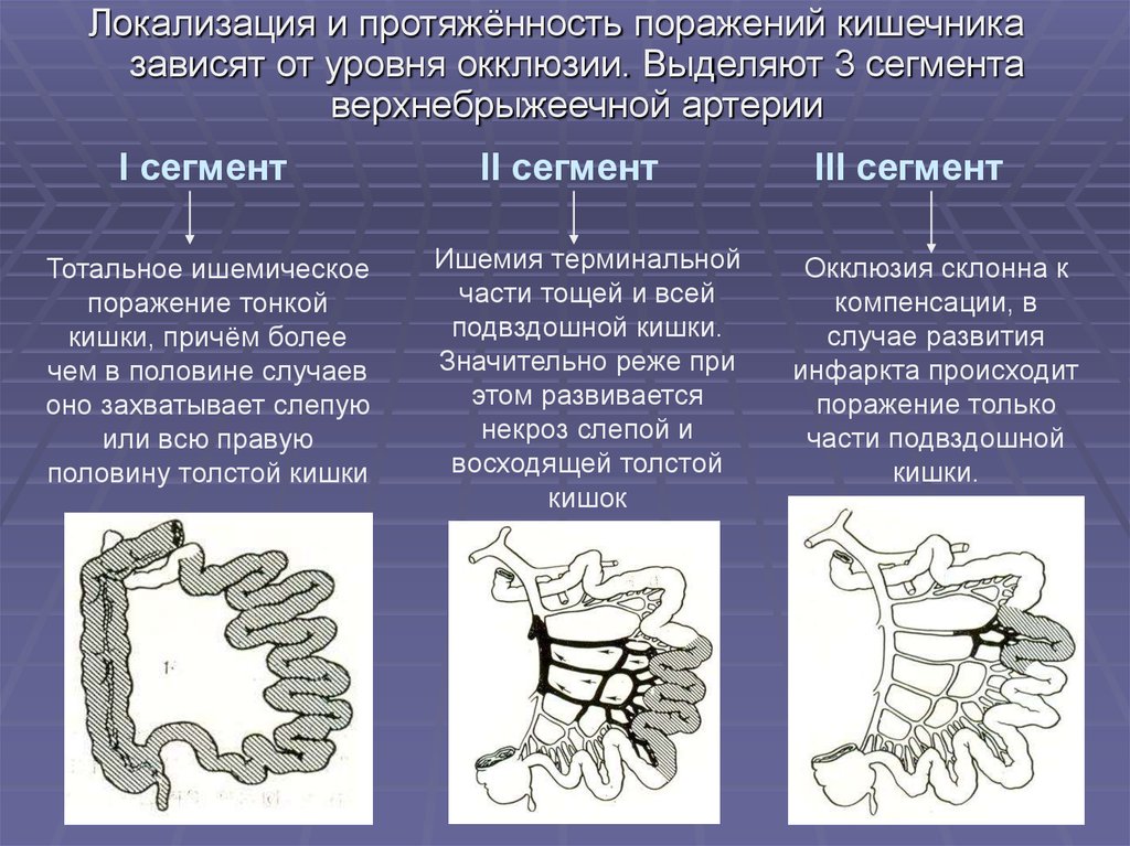 Синдром мезентериальной ишемии презентация