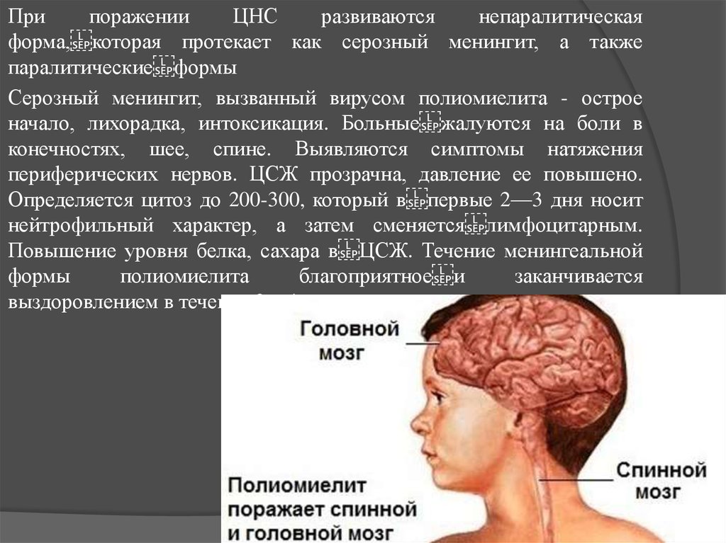 Диагностика полиомиелита