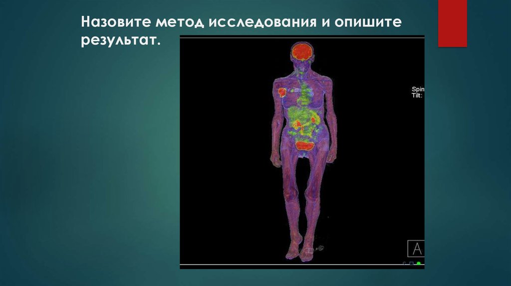 Назовите метод исследования и опишите результат.