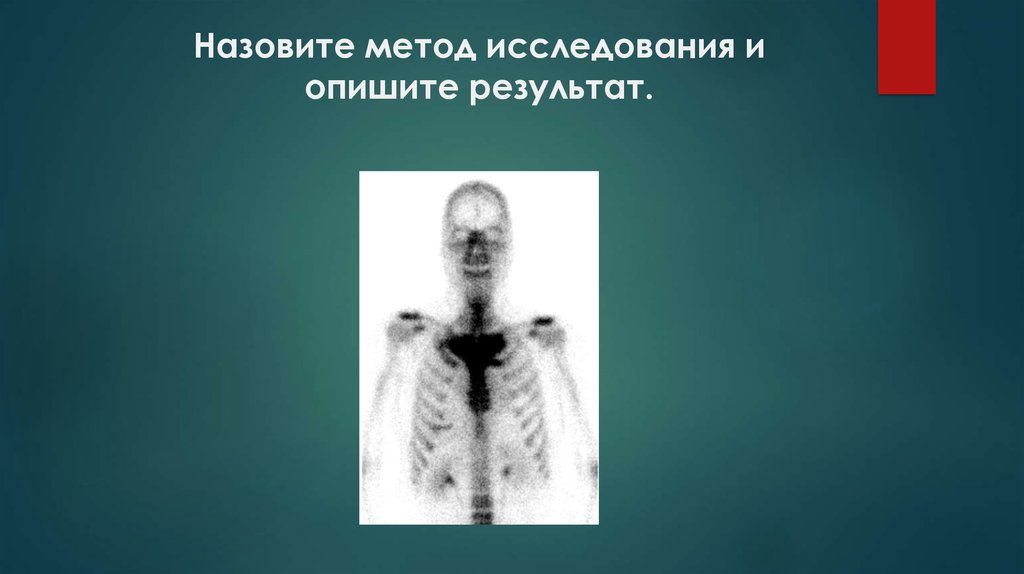 Назовите метод исследования и опишите результат.