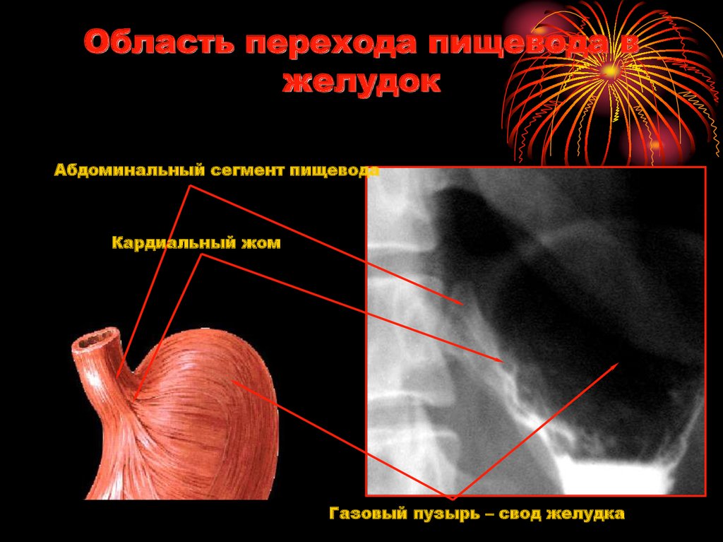 Рентгеноанатомия жкт презентация