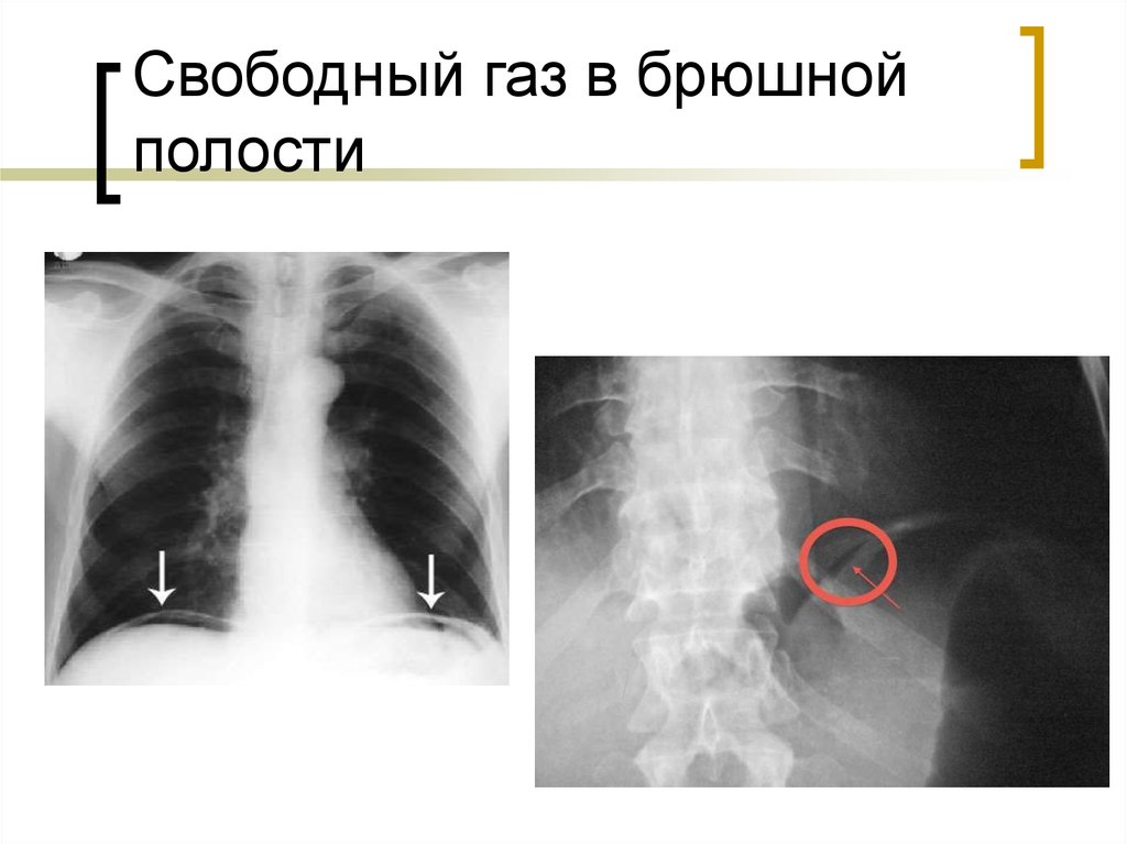 Свободный газ