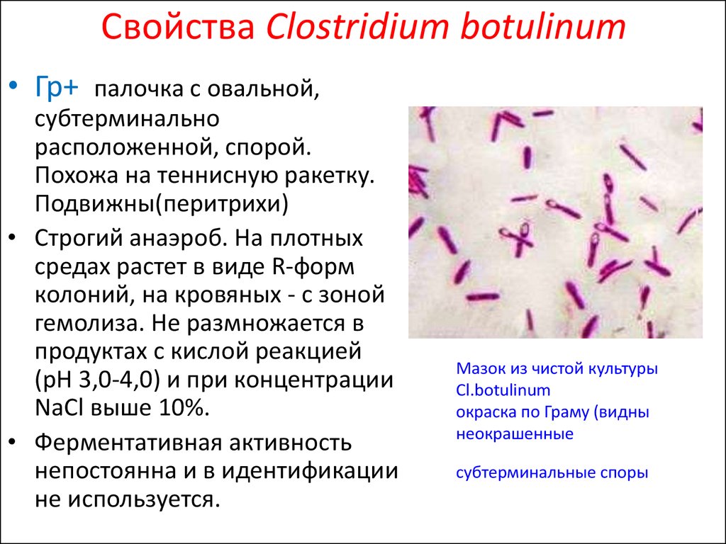 Кластридии. Палочки ботулизма Clostridium botulinum. Клостридии ботулизма ( Clostridium botulinum ) ботулизм. Clostridium botulinum окраска. Морфологические свойства Clostridium botulinum.