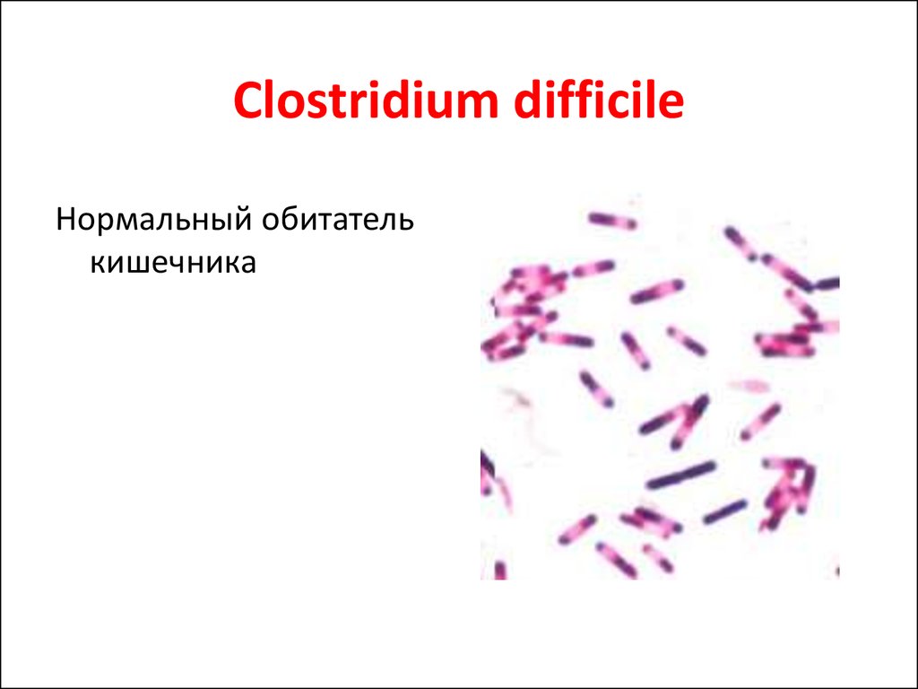 Клостридиум диффициле
