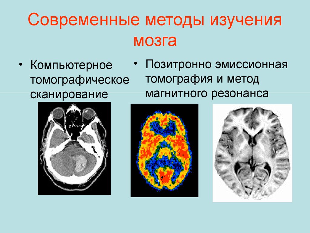 На сколько изучен мозг