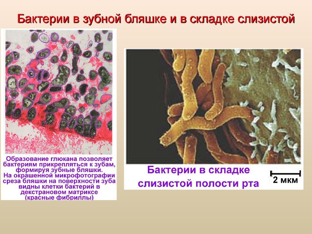 Бактерии в слюне. Микроорганизмы зубной бляшки. Зубная бляшка микробиология. Микробиология ротовой полости. Микроорганизмы в ротовой полости микробиология.