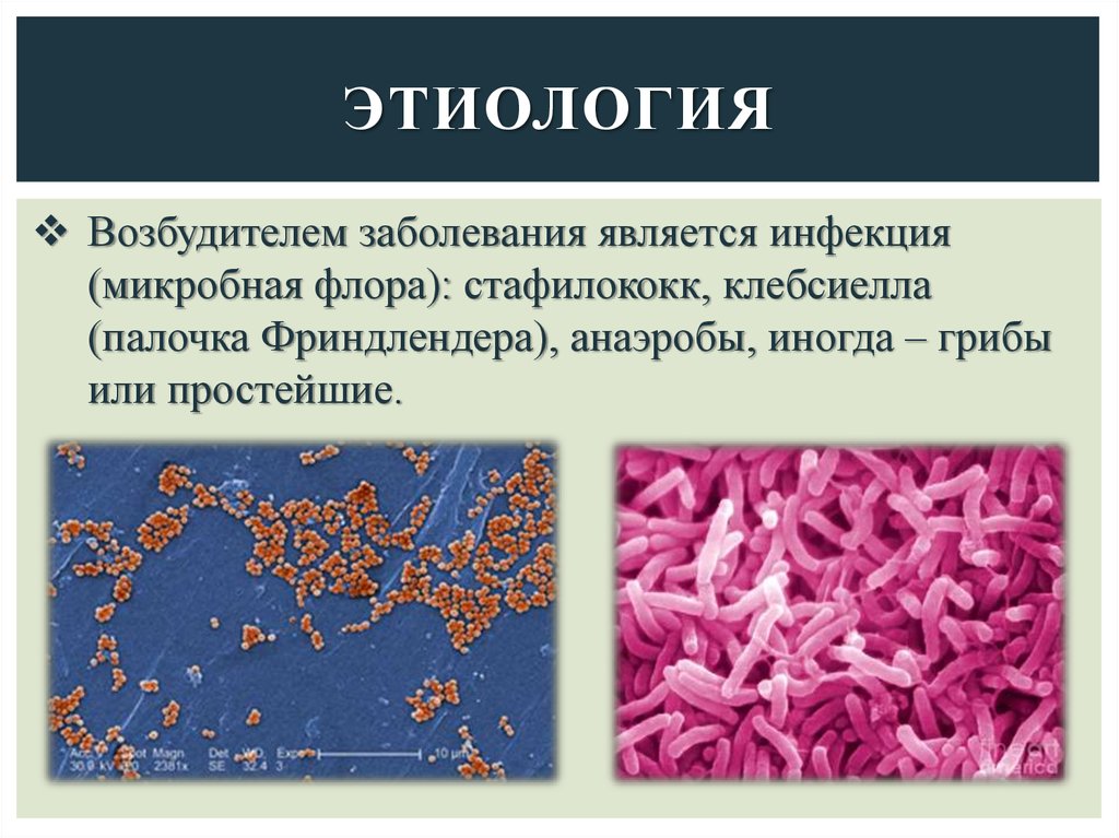 Микобактерии заболевания