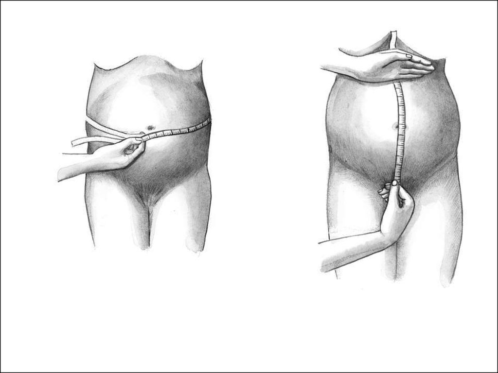 Измерение окружности живота беременной. Методы обследования в акушерстве. Методы обследования беременных Акушерство. Акушерские методы исследования беременной. Наружный метод исследования в акушерстве.