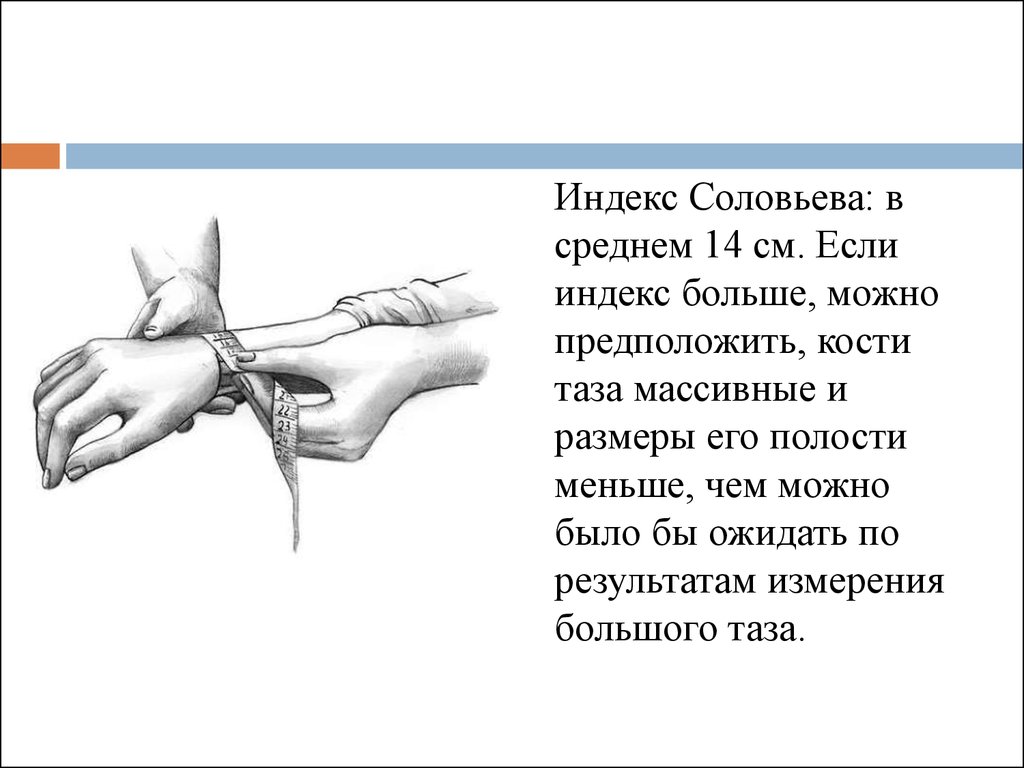 Формула соловьева. Индекс Соловьева в акушерстве норма. Проведение измерения наружных размеров таза индекс Соловьева. Окружность запястья индекс Соловьева. Метод Соловьева в акушерстве.