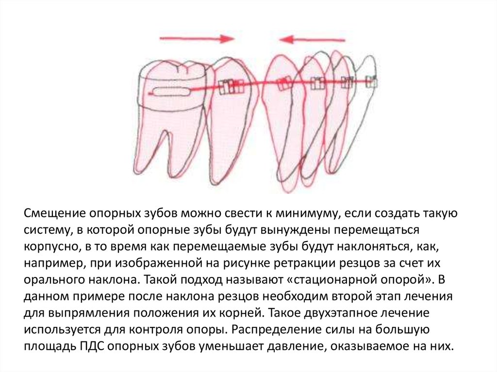 Биомеханика ортодонтия презентация