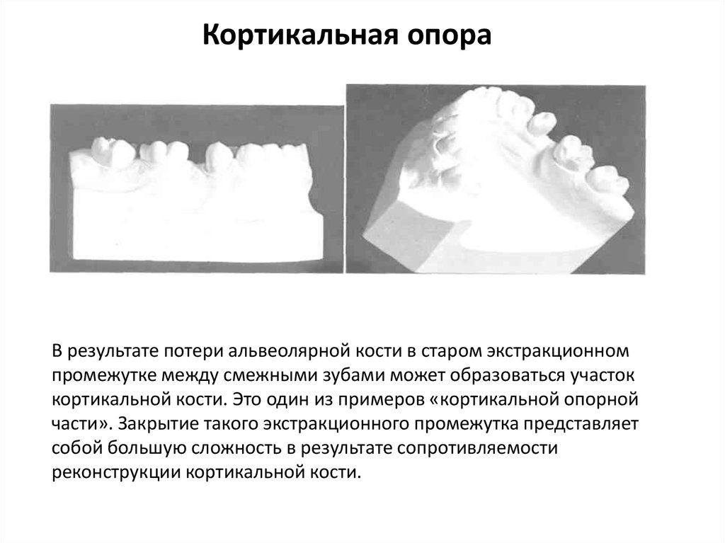 Биомеханика ортодонтия презентация