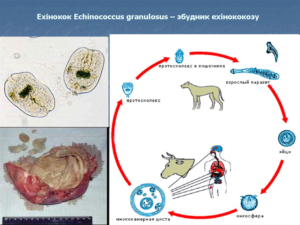 Чем опасен эхинококк для человека. Онкосфера эхинококка. Ленточного гельминта эхинококка. Echinococcus granulosus жизненный цикл.