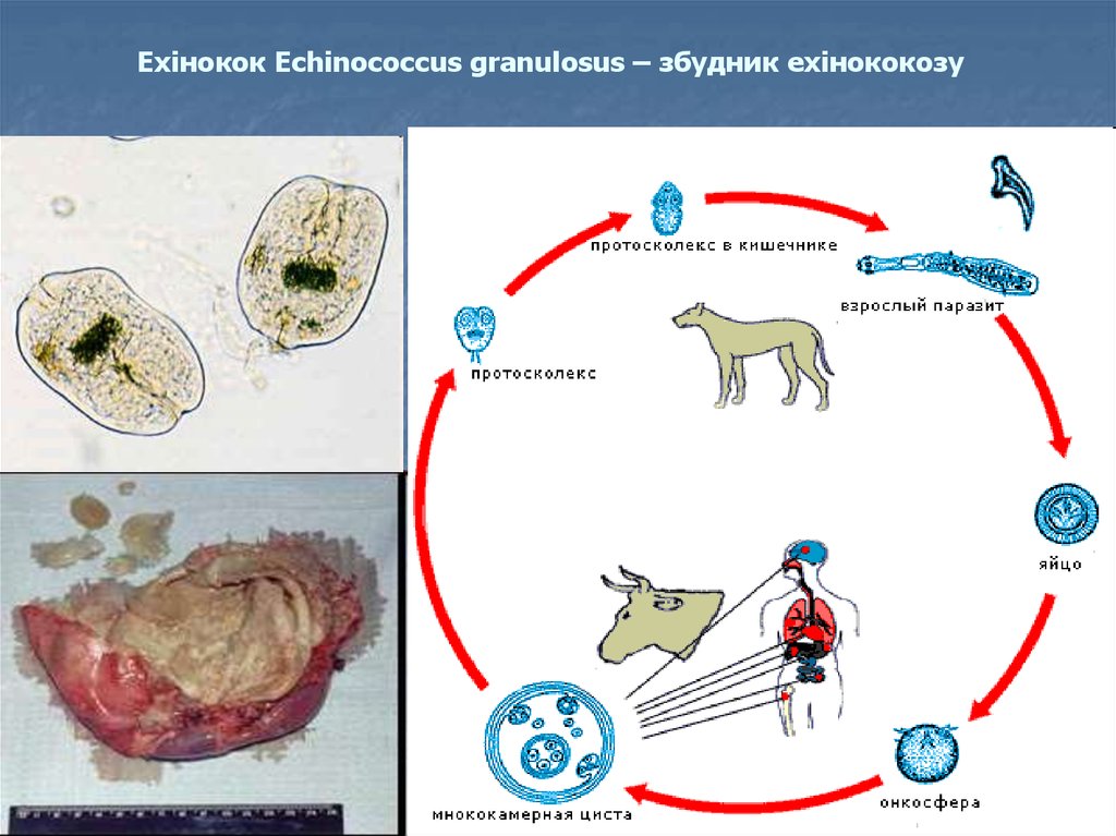 Признаки характерные для эхинококка в живом организме. Онкосфера эхинококка. Ленточного гельминта эхинококка. Echinococcus granulosus жизненный цикл.