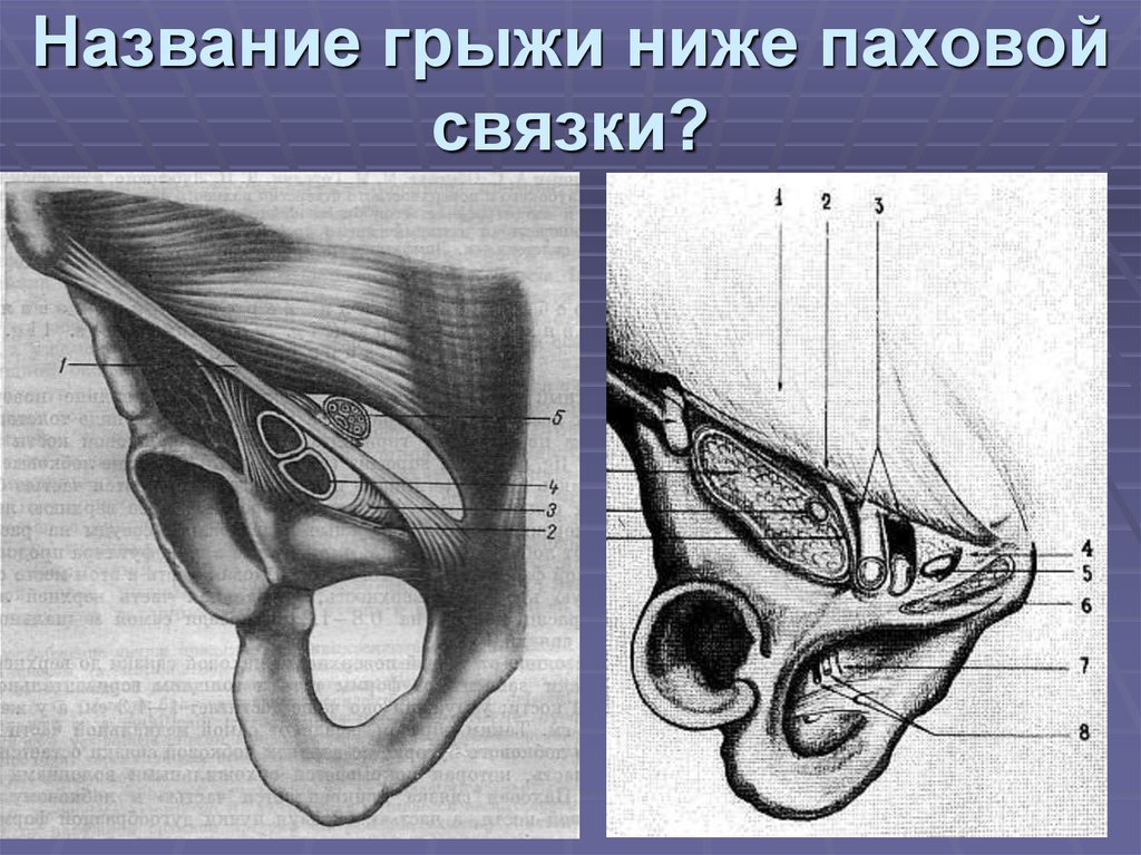 Паховая связка. Жимбернатова связка анатомия. Паховая пупартова связка. Пупартова связка и паховая связка.