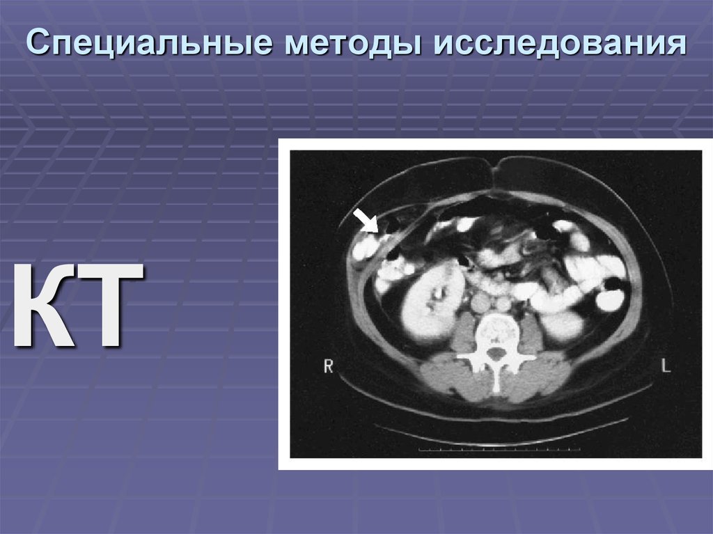 Специальные методы исследования