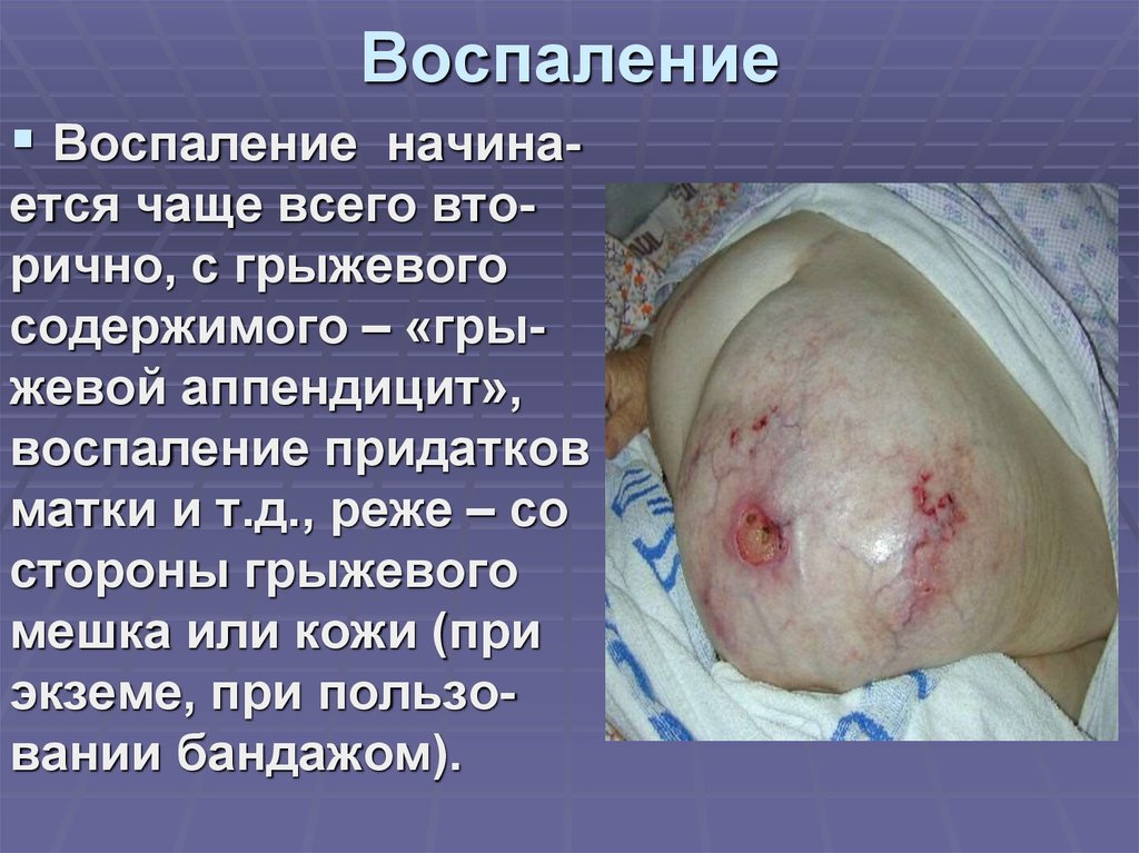 Воспаление