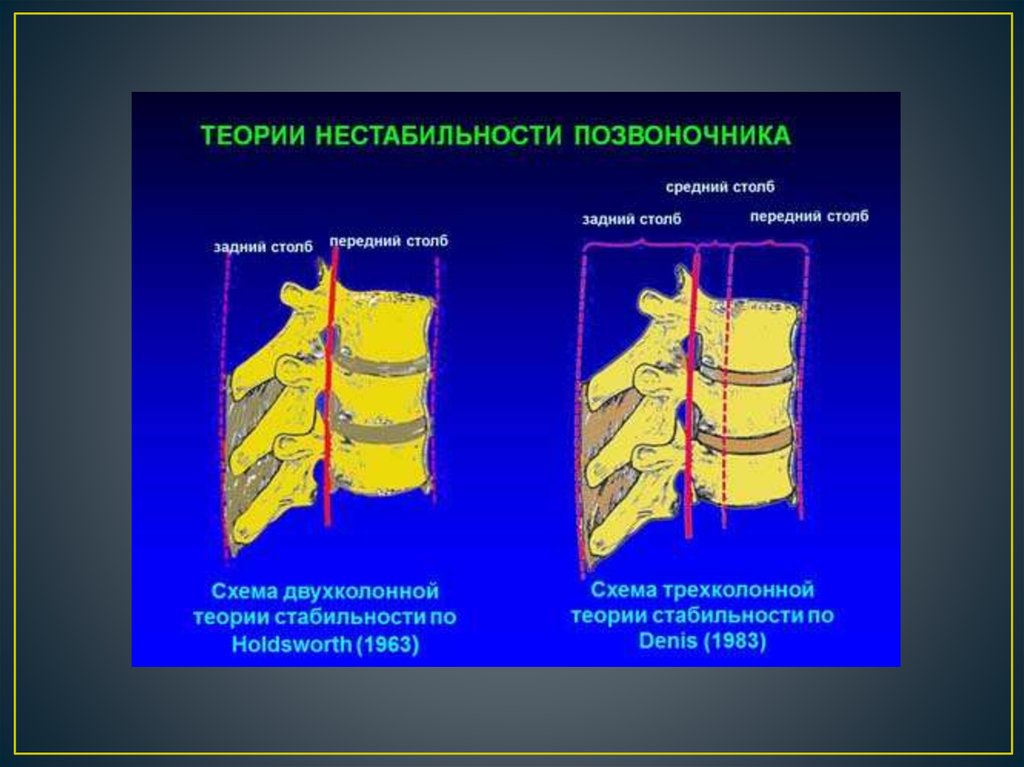 Задние столбы спинного. Опорные колонны позвоночника. Нестабильные повреждения позвоночника. Теория стабильности позвоночника. Передние и задние структуры позвоночника.