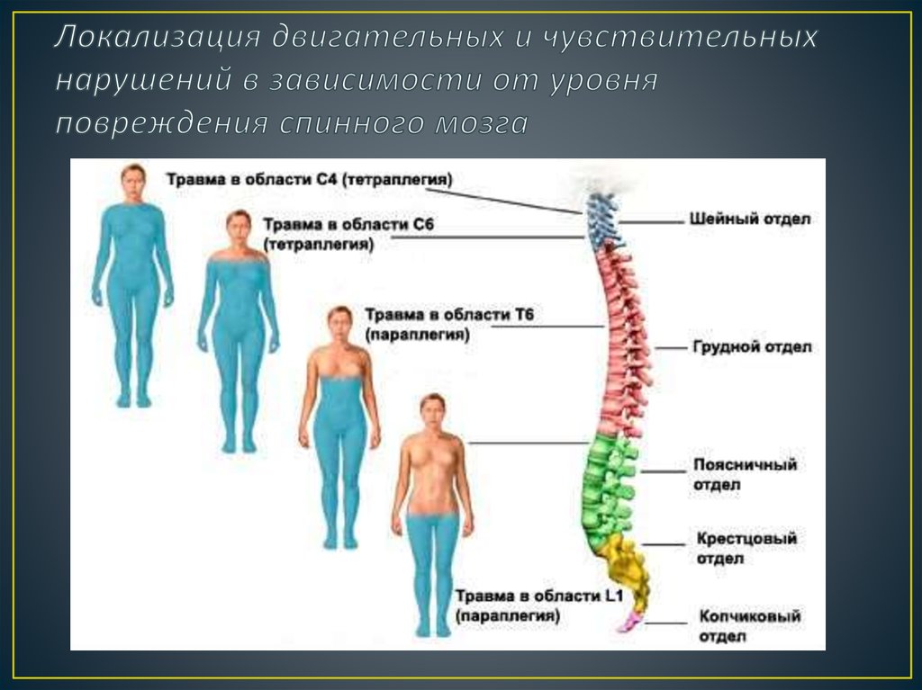 Локализация двигательных и чувствительных нарушений в зависимости от уровня повреждения спинного мозга