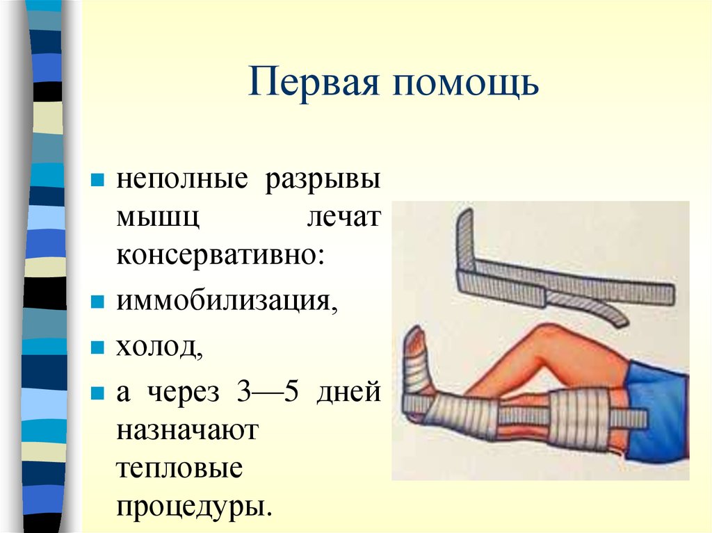 Первая помощь при повреждении мышц. Травматические повреждения первая помощь. Иммобилизация при травмах опорно-двигательного аппарата. Разрыв мышц первая помощь.