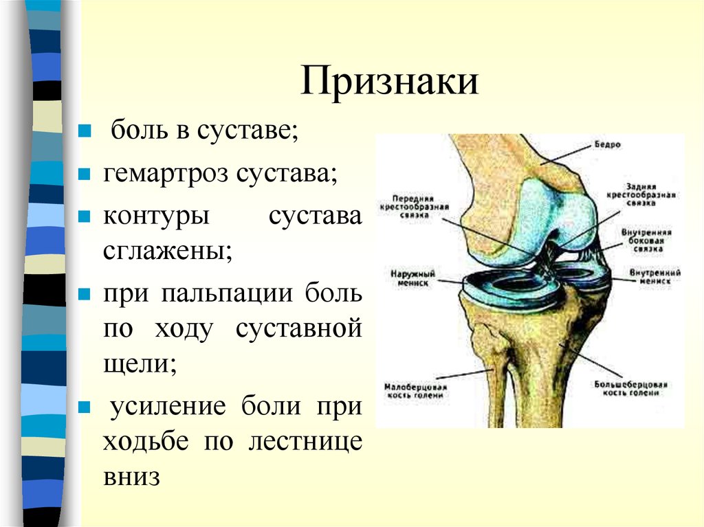 Болит колено при ходьбе чем лечить. Боль кв колени при ходьбе. Болит сустав колена при ходьбе.