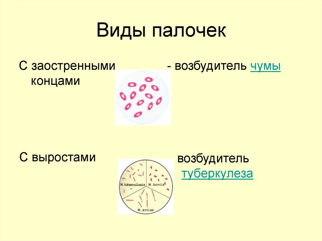 Конец формы. Палочки с заостренными концами бактерии. Виды палочек. Кокковидная форма палочки.