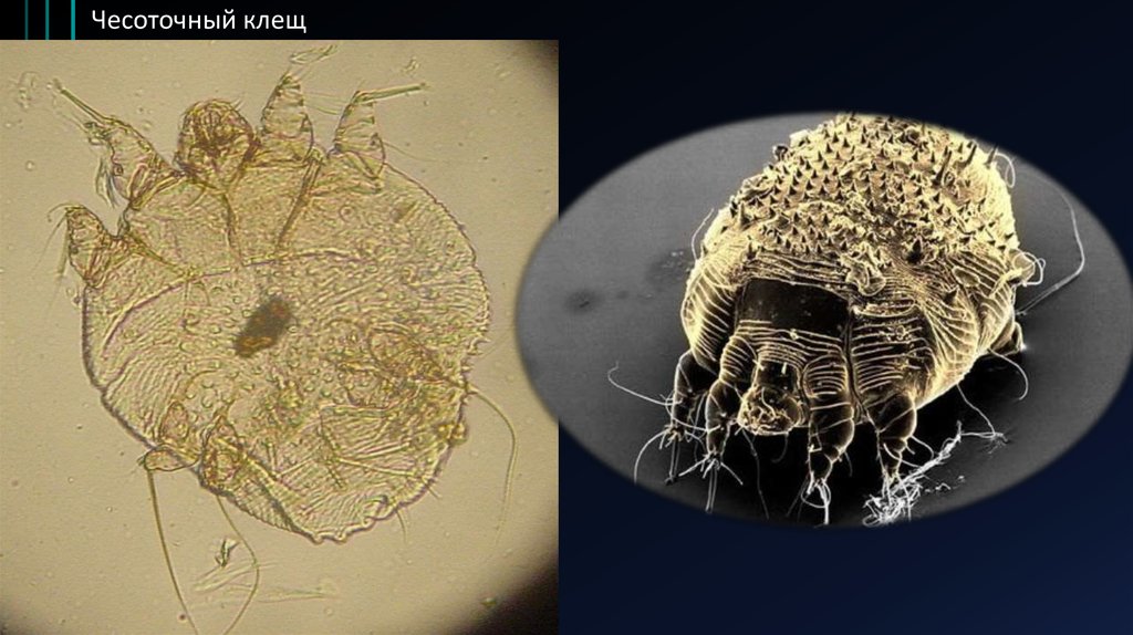 Чесоточный зудень. Чесоточный зудень под микроскопом 25. Чесоточный клещ есть стадия куколки. Дыхательная система чесоточного клеща.