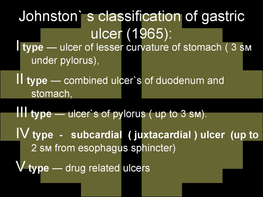 Johnston` s classification of gastric ulcer (1965):