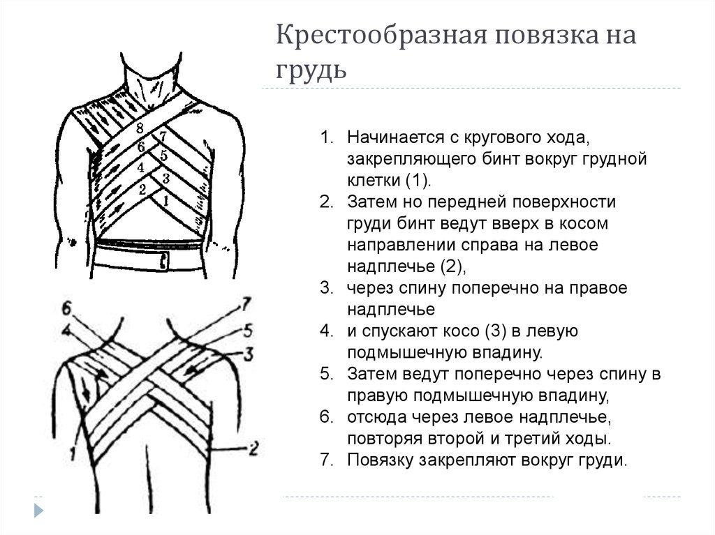 Крестообразная повязка. Крестообразная повязка на грудную клетку показания. Наложение повязки на грудную клетку алгоритм. Восьмиобразная повязка на грудную клетку алгоритм. Перевязка крестообразная на грудную клетку.