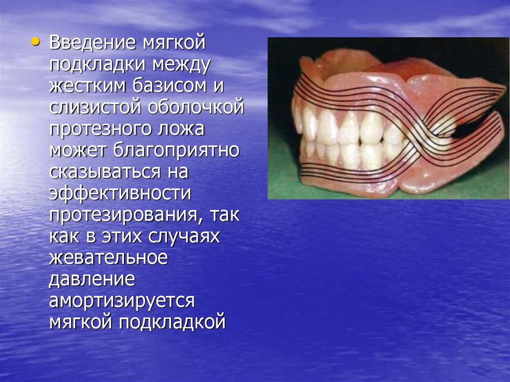 Протезное поле и протезное ложе. Двухслойные базисы протезов при полном. Двухслойный Базис съемного протеза. Полный съемный протез с двухслойным базисом. Съемный пластиночный протез с двухслойным базисом.