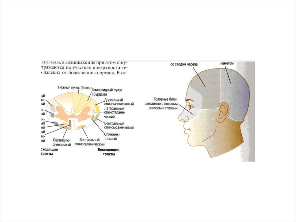 Боль в теменной области головы. Схема локализации головной боли. Классификация головной боли по локализации. Зоны головы локализация боли. Болит голова в лобной части.