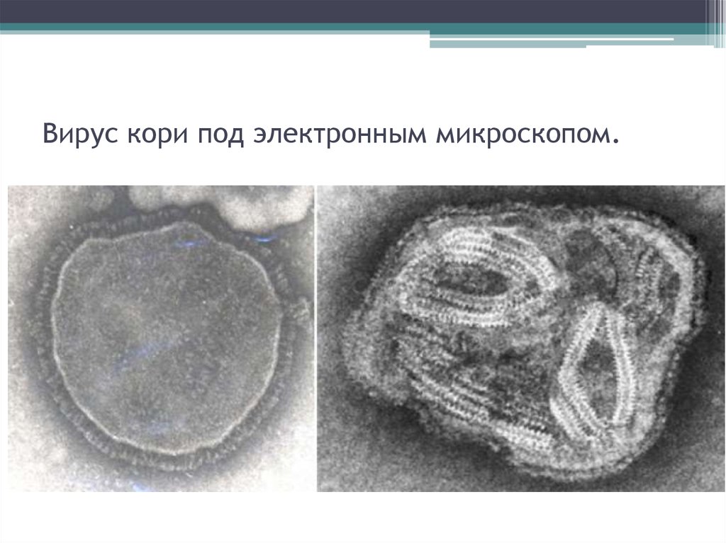 Вирус кори рисунок микробиология