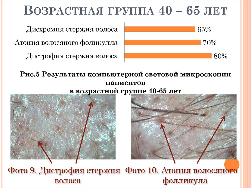 Возрастная группа 40 – 65 лет