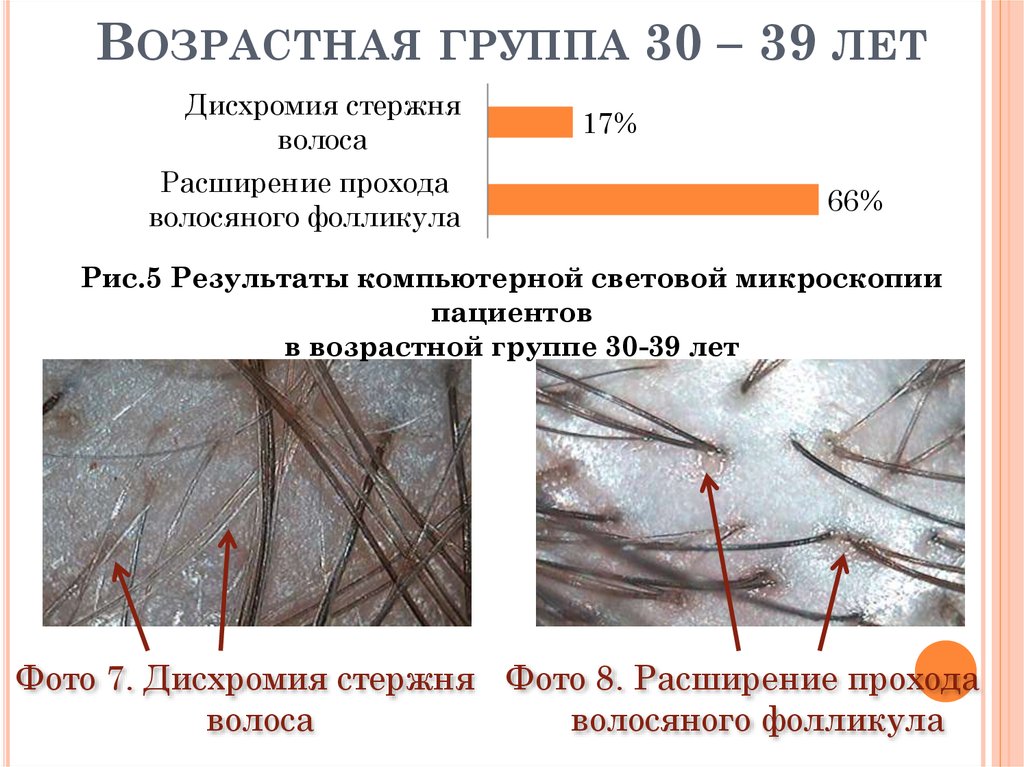 Возрастная группа 30 – 39 лет