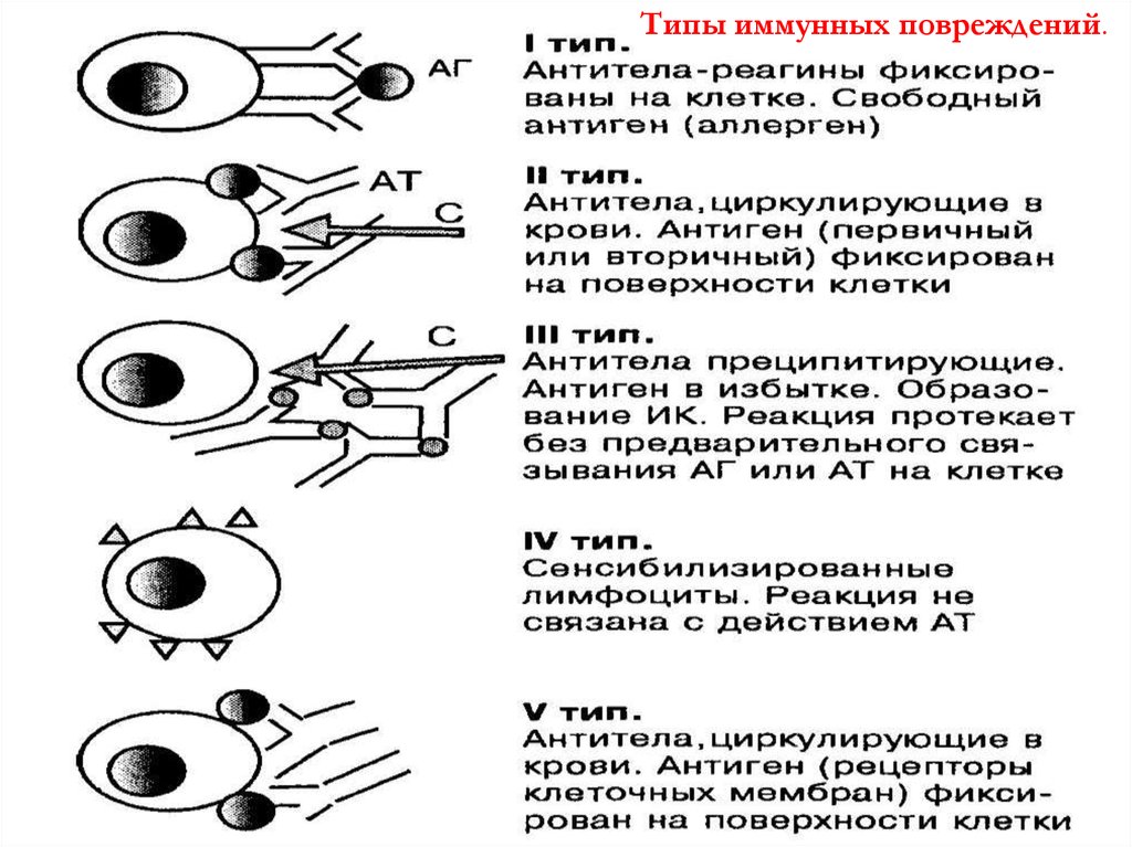 Реакции иммунного повреждения. 4 Тип иммунного повреждения тканей. Реакции иммунного повреждения II (цитотоксического) типа. Типы иммунных механизмов повреждения тканей. 1 Тип иммунного повреждения.