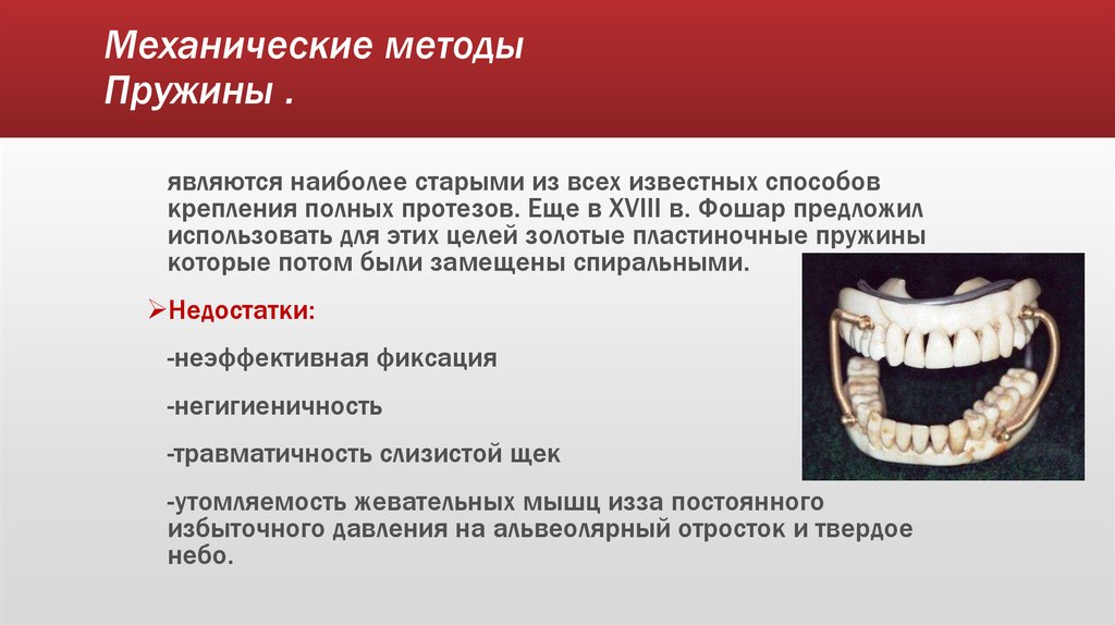 Методы фиксации и стабилизации съемных протезов при полном отсутствии зубов презентация