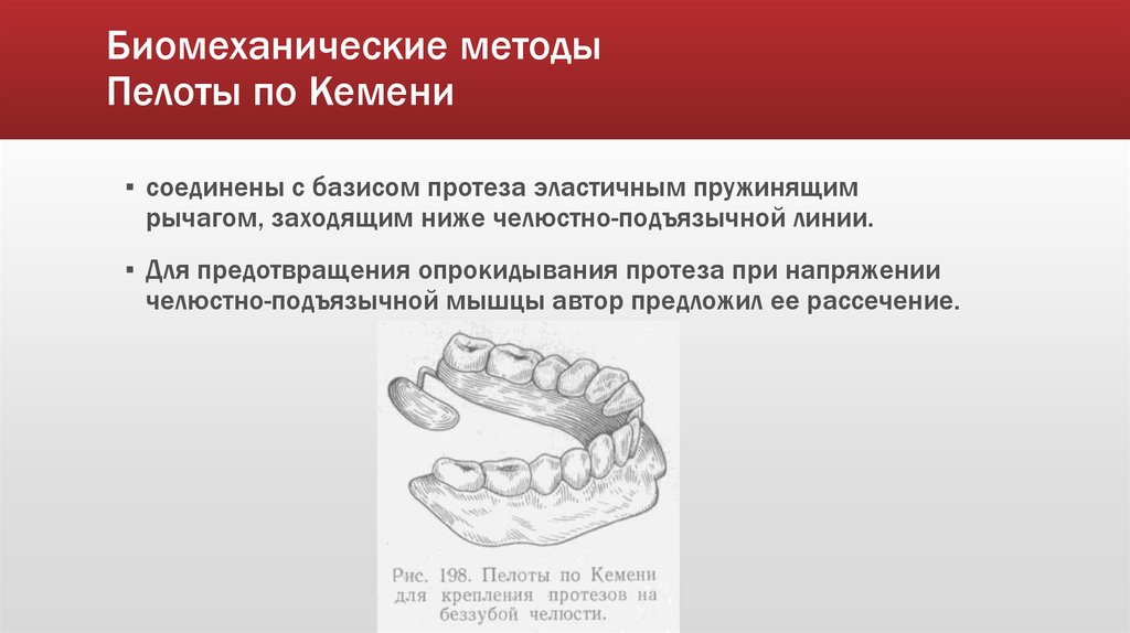 Методы фиксации и стабилизации съемных протезов при полном отсутствии зубов презентация