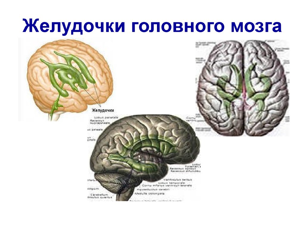 Желудочки мозга схема