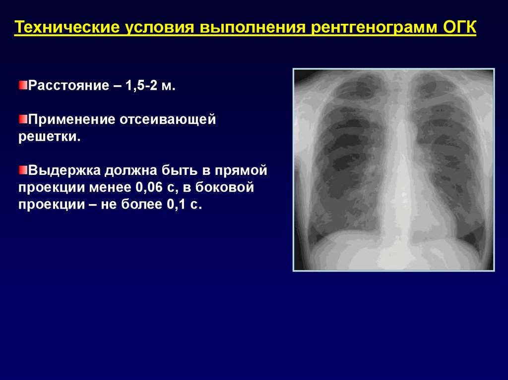 Единица цифрового изображения на рентгенограмме это