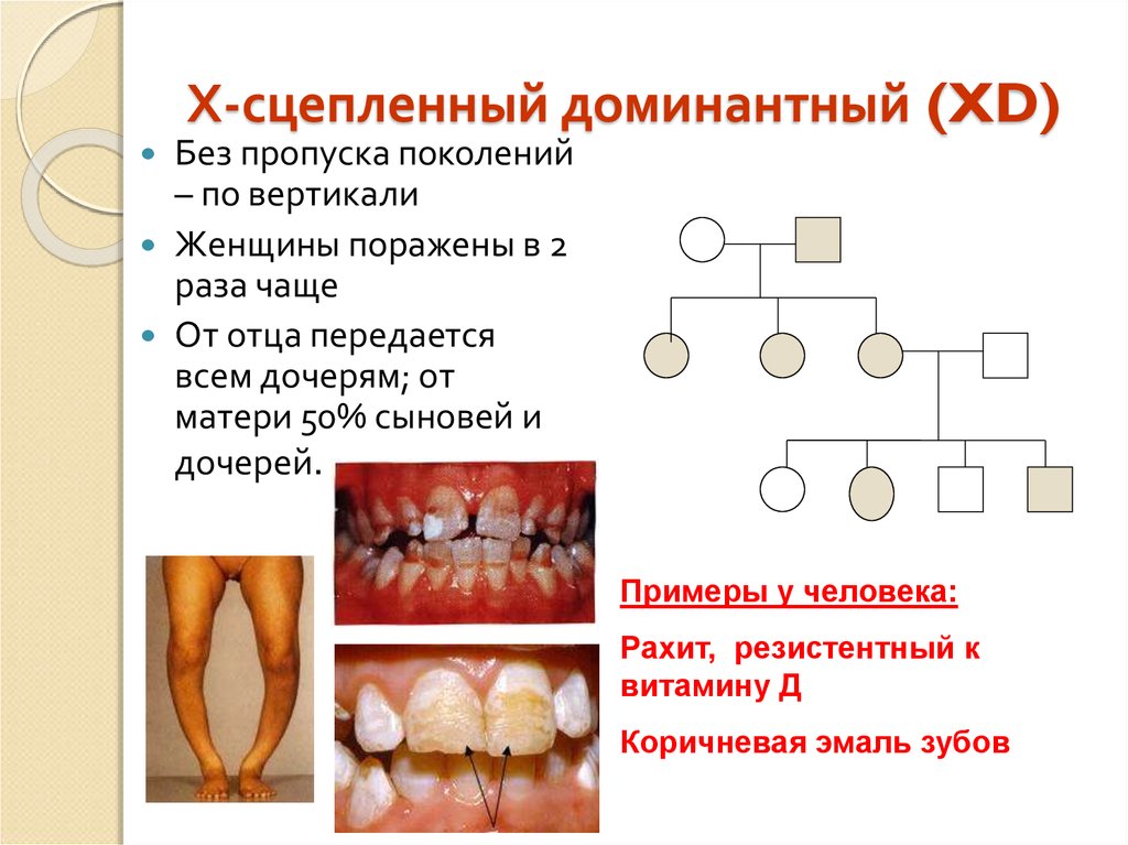 Х сцепленный