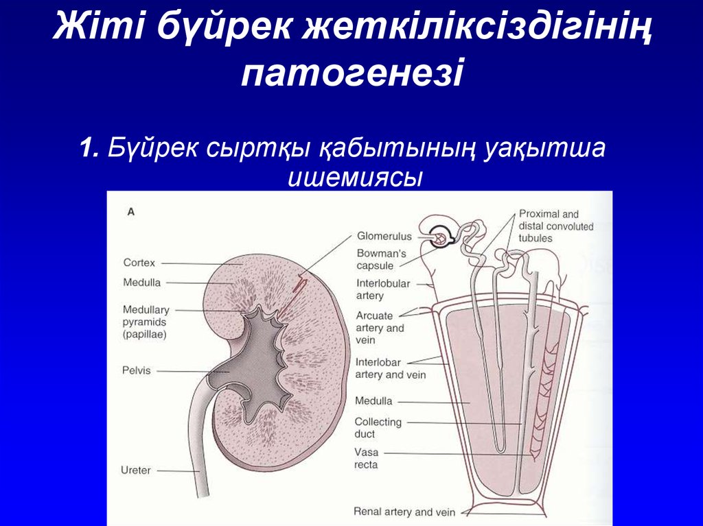 Бүйрек жетіспеушілігі презентация