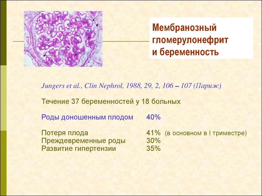 Мембранозный гломерулонефрит и беременность