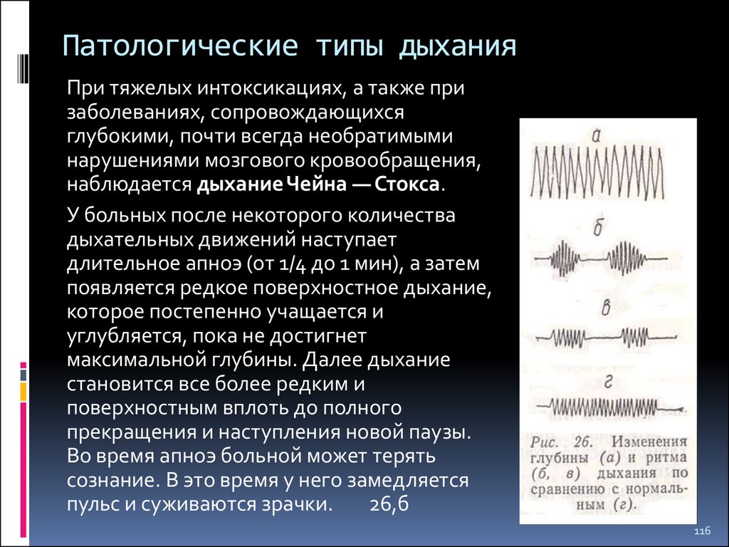 Глубина дыхания. Дыхание Чейна Стокса при. Дыхание Куссмауля или дыхание Чейна-Стокса. Типы периодического патологического дыхания. Ритм Чейна Стокса.