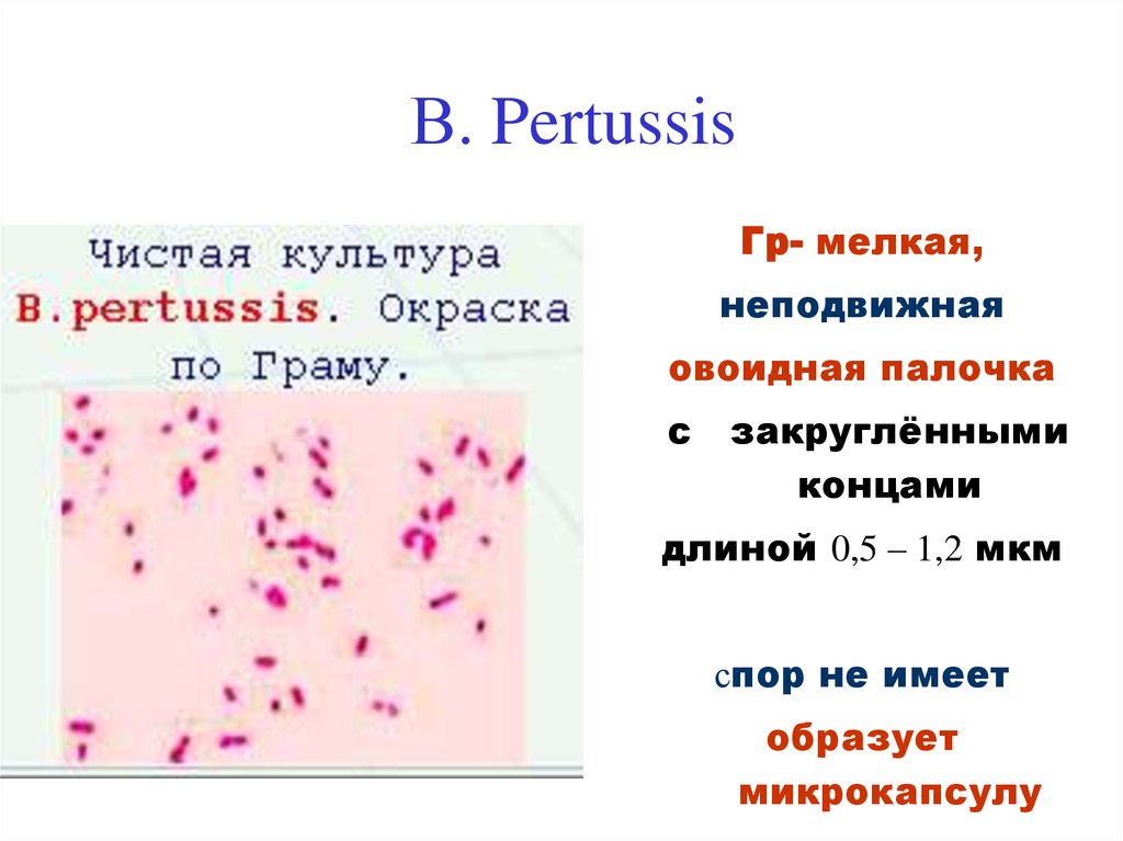 Коклюш презентация микробиология