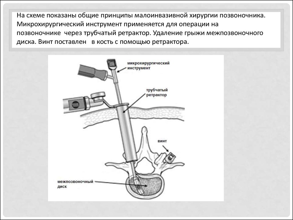 Малоинвазивная хирургия презентация