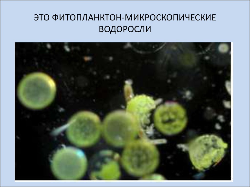 Фитопланктон образован. Фитопланктон диатомовые водоросли. Микроскопические водоросли. Фитопланктон зеленые водоросли. Фитопланктон микроскопические водоросли.