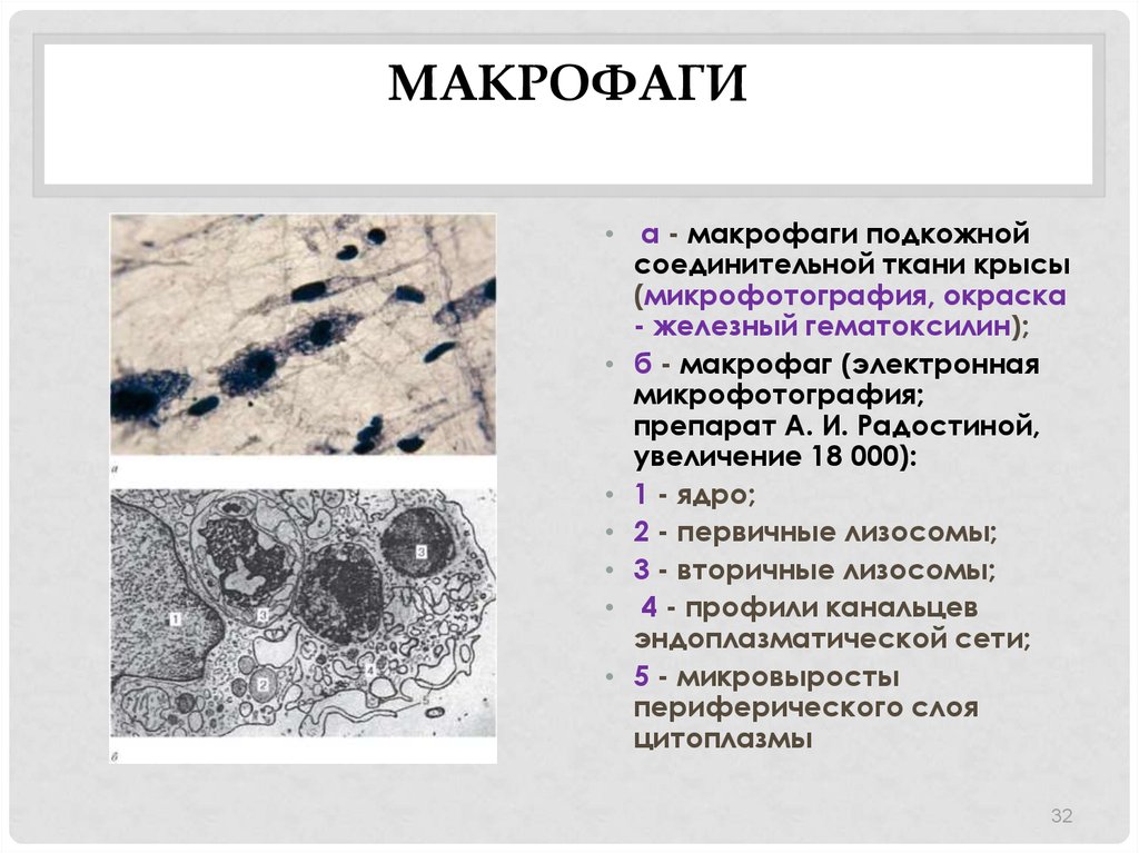 Макрофаги в тканях. Тканевые макрофаги соединительной ткани. Тучная клетка Электронограмма. Макрофаги соединительной ткани строение и функции. Пенистые макрофаги гистология.
