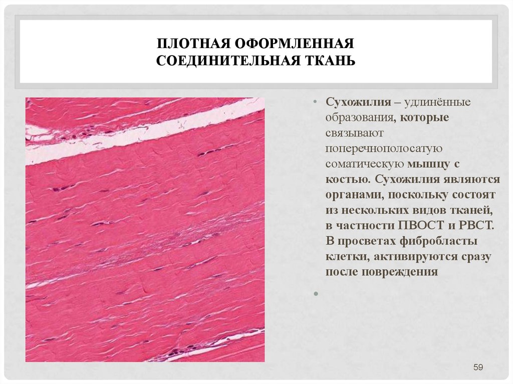 Плотная соединительная ткань. Плотная оформленная соединительная ткань состоит из:. Плотная неоформленная соединительная ткань образует. Плотная оформленная соединительная ткань функции. Плотная оформленная соединительная ткань сухожилия.