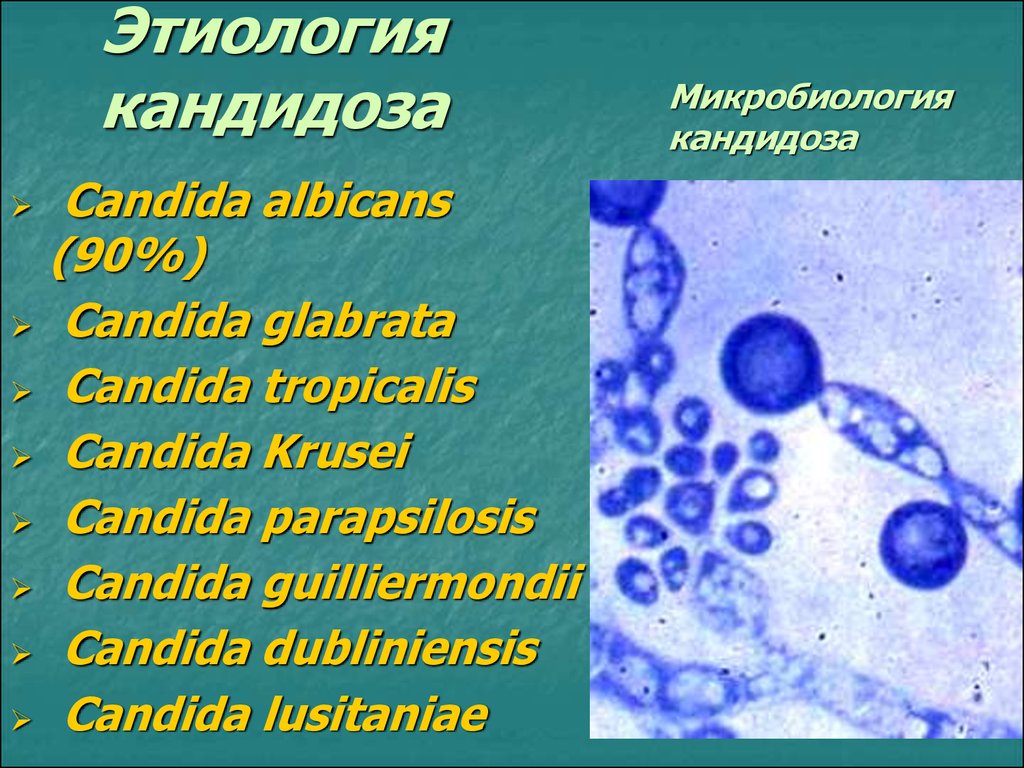 Кандида цистит. Кандидоз этиология. Кандида глабрата под микроскопом.