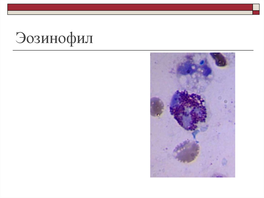 Выпотные жидкости презентация